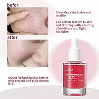 Anua - Korean Serum 10% Niacinamide+ 4% Tranexamic Acid Serum , Anti skin discoloration Anua - Korean Serum 10% Niacinamide+ 4% Tranexamic Acid Serum , Anti skin discoloration
