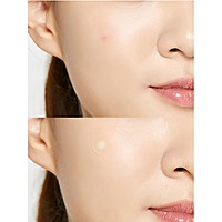 Cosrx - Acne Pimple Master Patch 24patches - Korean Skin Care Cosrx - Acne Pimple Master Patch 24patches - Korean Skin Care